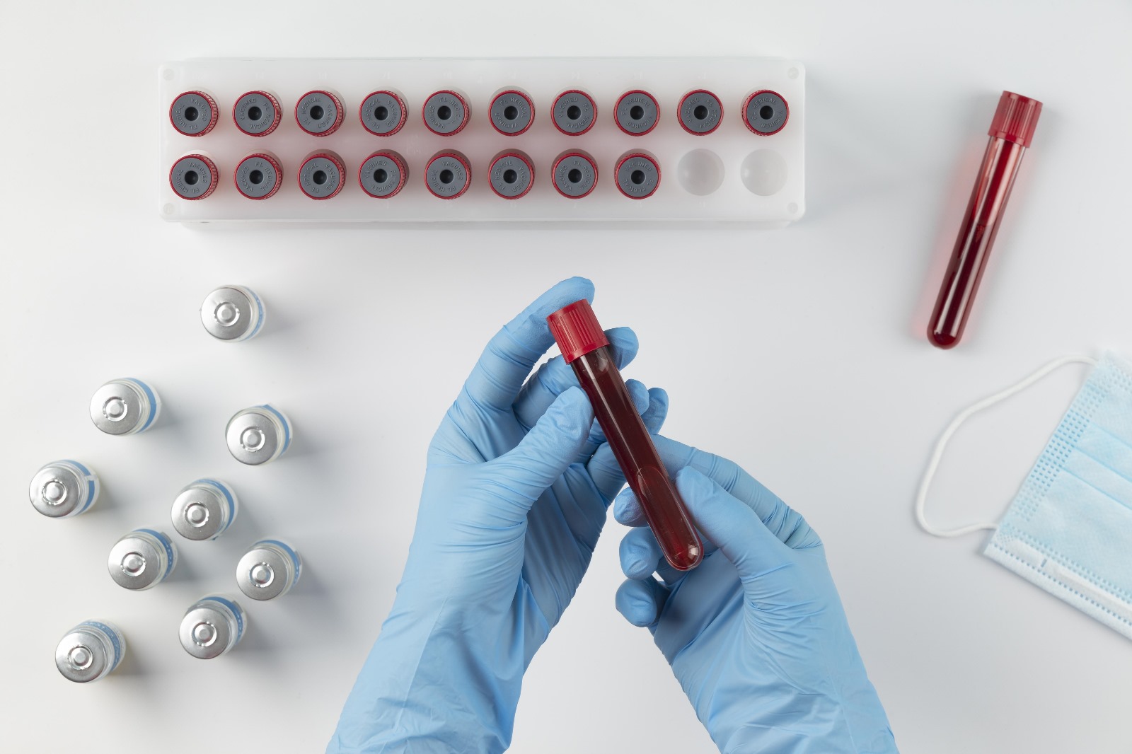 Hematology Tests