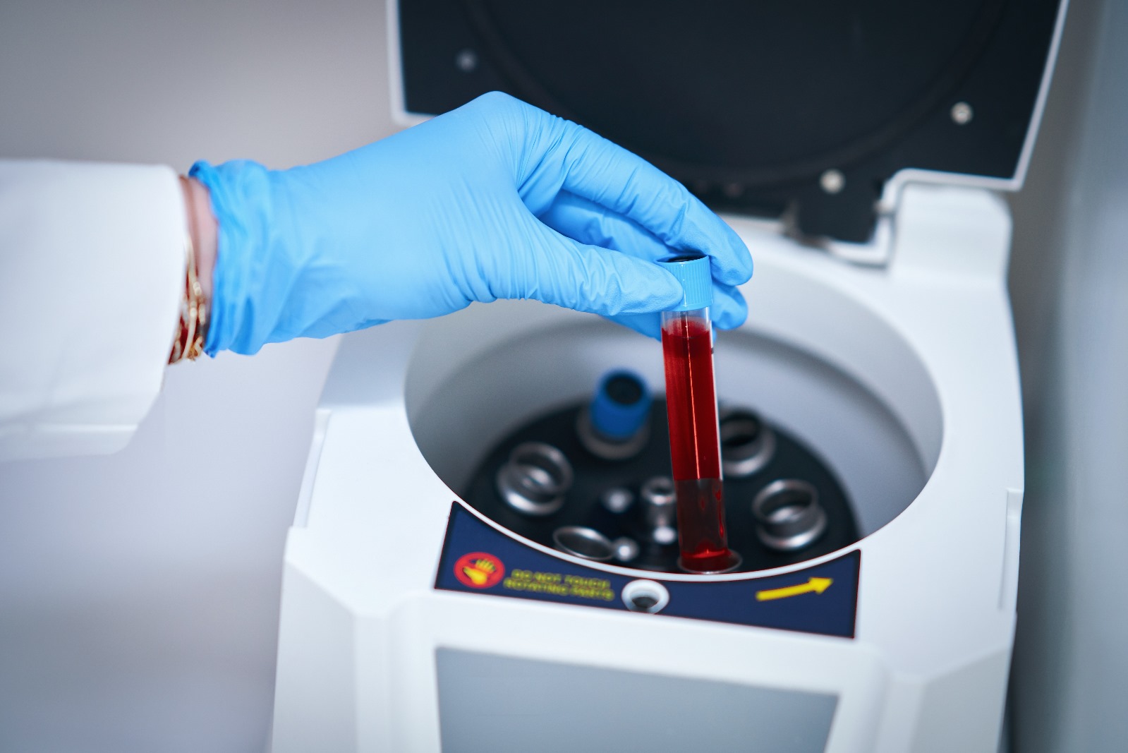 Serological Tests