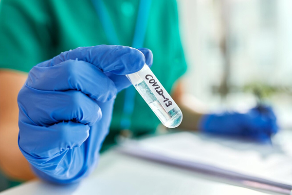 PCR Test: What You Need to Know